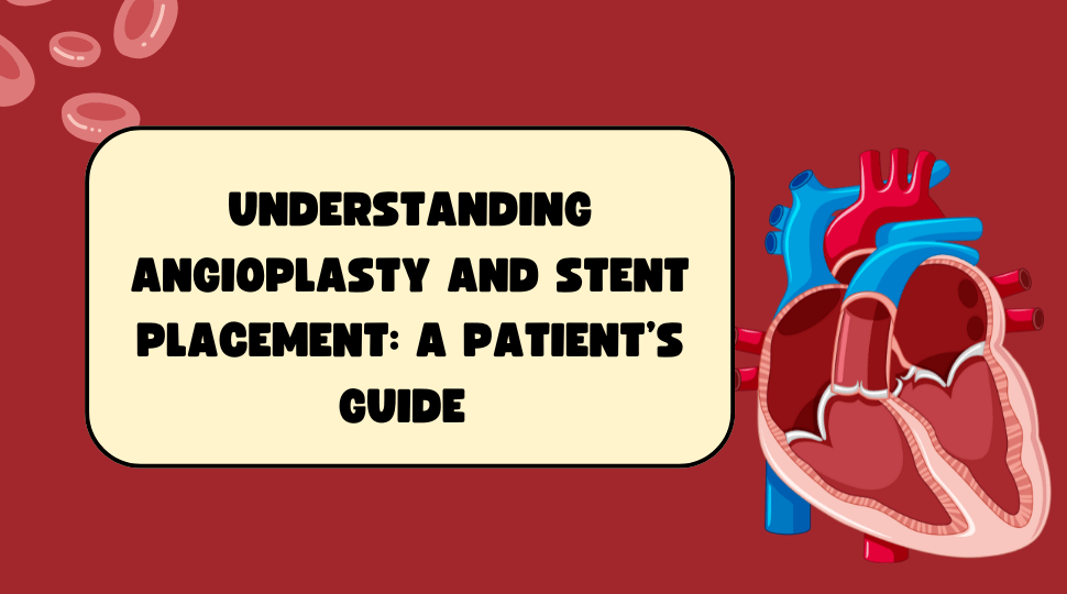 Understand Angioplasty and stent placement – a patient’s guide with a heart illustration.