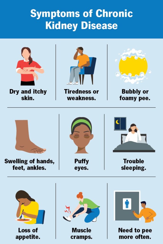 Chronic Kidney Disease (CKD) symptoms chart including itchy skin, tiredness, swelling, and frequent urination