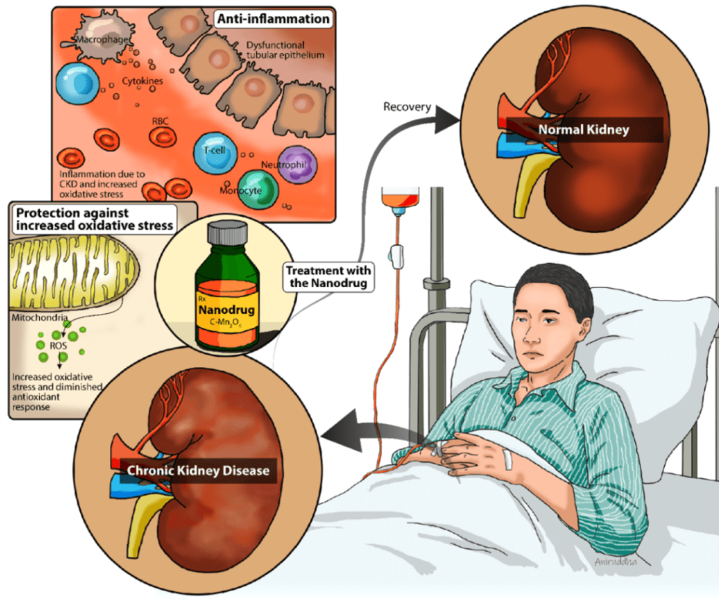 Kidney Disease Treatment symptoms infographic with signs like swelling, foamy urine, and tiredness
