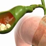 Modern hospital infrastructure for advanced hernia diagnosis and treatment in Ahmedabad