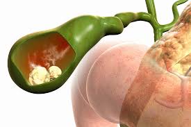 Modern hospital infrastructure for advanced hernia diagnosis and treatment in Ahmedabad