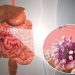 Medical professional analyzing scan results for GI cancer treatment in Ahmedabad