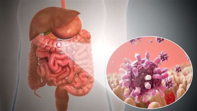 Medical professional analyzing scan results for GI cancer treatment in Ahmedabad