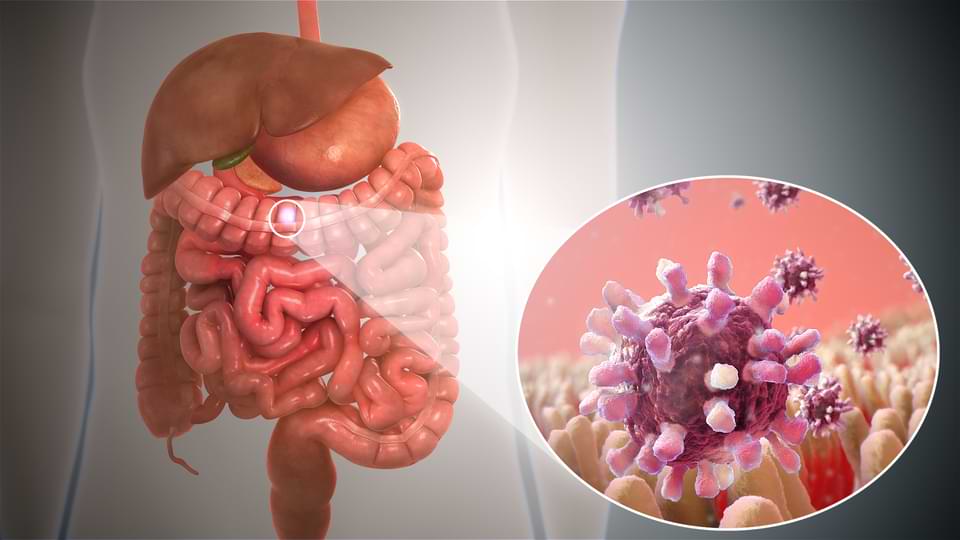 Medical professional analyzing scan results for GI cancer treatment in Ahmedabad