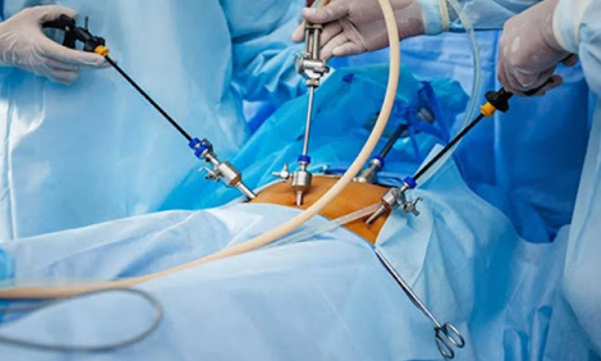 Surgeon performing laparoscopic hernia repair treatment with precision instruments in minimally invasive procedure