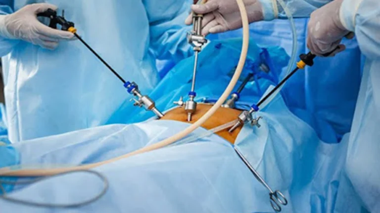Surgeon performing laparoscopic hernia repair treatment with precision instruments in minimally invasive procedure