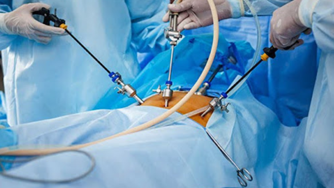 Surgeon performing laparoscopic hernia repair treatment with precision instruments in minimally invasive procedure
